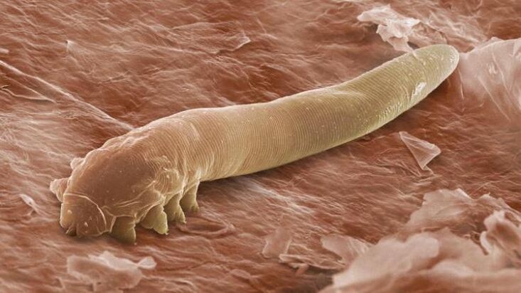 črv, ki živi pod človeško kožo