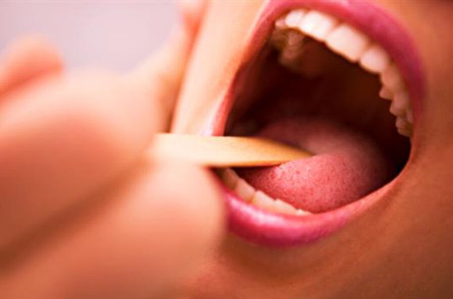 Vrste parazitov v človeških ustih